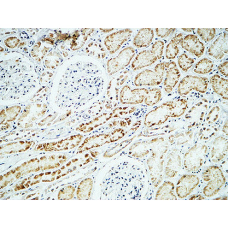 Immunohistochemistry - Anti-CRYAB Antibody (B0895) - Antibodies.com