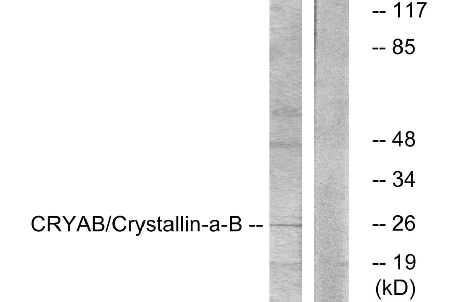 Western Blot - Anti-CRYAB Antibody (B0897) - Antibodies.com