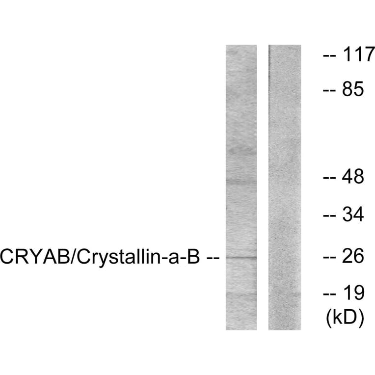 Western Blot - Anti-CRYAB Antibody (B0897) - Antibodies.com