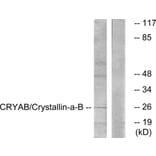 Western Blot - Anti-CRYAB Antibody (B0897) - Antibodies.com