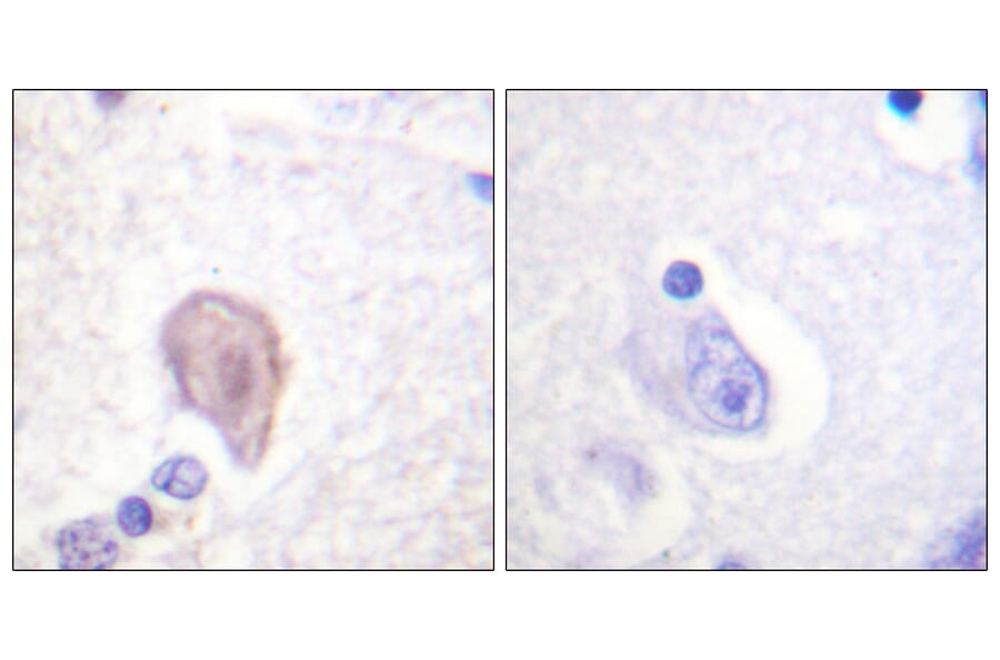 Immunohistochemistry - Anti-C-RAF Antibody (B0893) - Antibodies.com