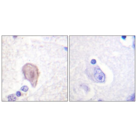 Immunohistochemistry - Anti-C-RAF Antibody (B0893) - Antibodies.com