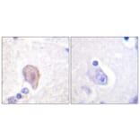 Immunohistochemistry - Anti-C-RAF Antibody (B0893) - Antibodies.com