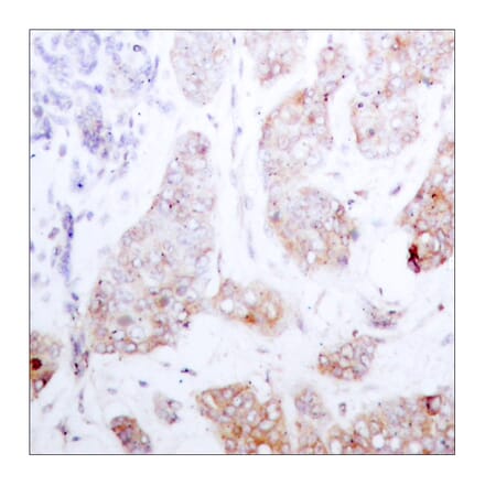 Immunohistochemistry - Anti-C-RAF Antibody (B7206) - Antibodies.com
