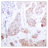 Immunohistochemistry - Anti-C-RAF Antibody (B7206) - Antibodies.com