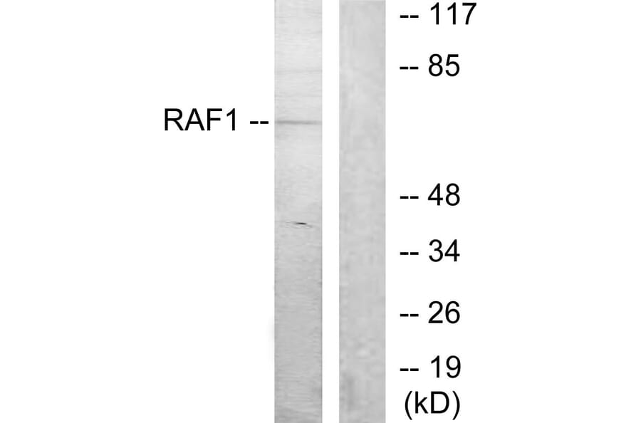 Western Blot - Anti-C-RAF Antibody (B7206) - Antibodies.com