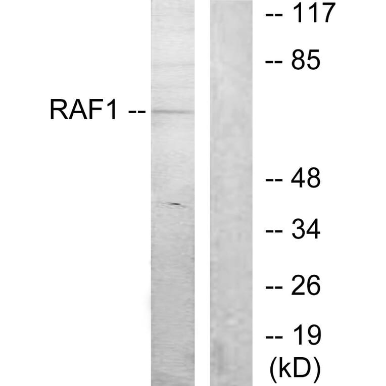 Western Blot - Anti-C-RAF Antibody (B7206) - Antibodies.com