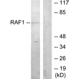 Western Blot - Anti-C-RAF Antibody (B7206) - Antibodies.com