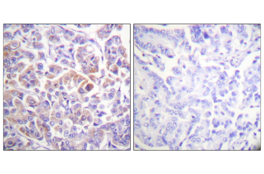 Immunohistochemistry - Anti-C-RAF Antibody (B0634) - Antibodies.com