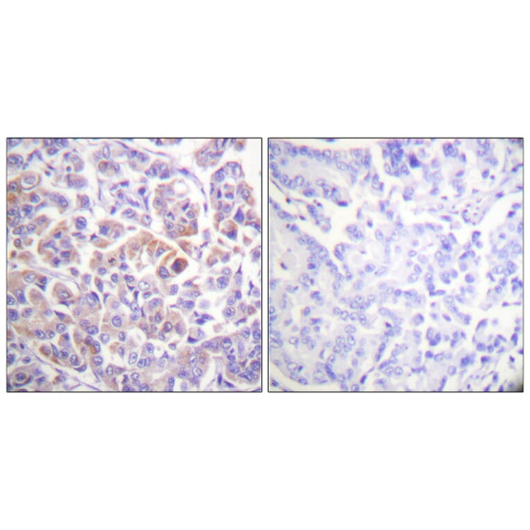 Immunohistochemistry - Anti-C-RAF Antibody (B0634) - Antibodies.com