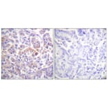 Immunohistochemistry - Anti-C-RAF Antibody (B0634) - Antibodies.com