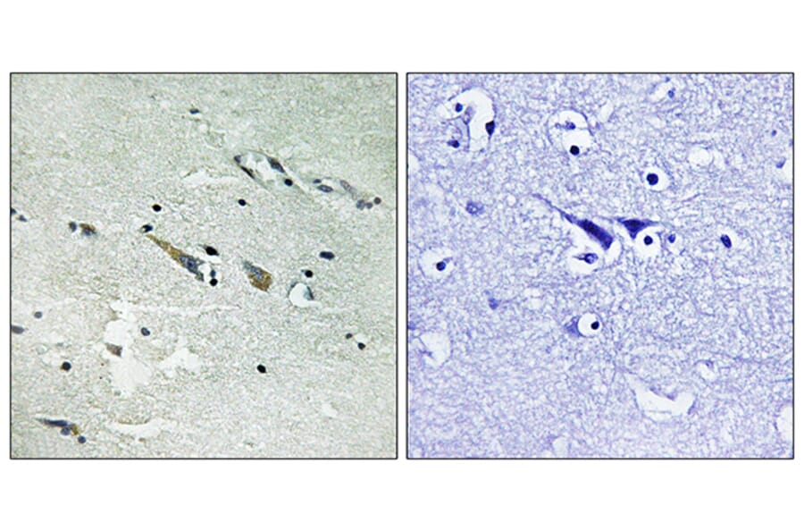 Immunohistochemistry - Anti-C-RAF Antibody (B8178) - Antibodies.com