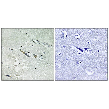Immunohistochemistry - Anti-C-RAF Antibody (B8178) - Antibodies.com