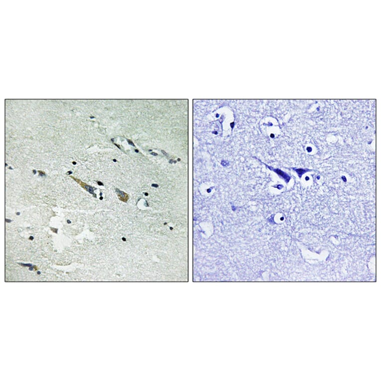 Immunohistochemistry - Anti-C-RAF Antibody (B8178) - Antibodies.com