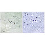 Immunohistochemistry - Anti-C-RAF Antibody (B8178) - Antibodies.com