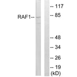 Western Blot - Anti-C-RAF Antibody (B8178) - Antibodies.com