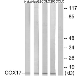 Western Blot - Anti-COX17 Antibody (C12231) - Antibodies.com