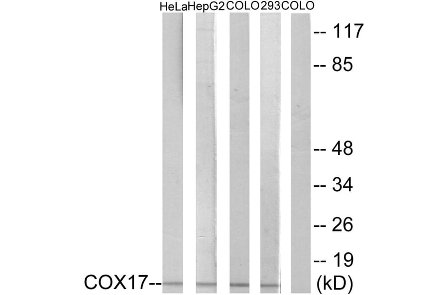 Western Blot - Anti-COX17 Antibody (C12231) - Antibodies.com