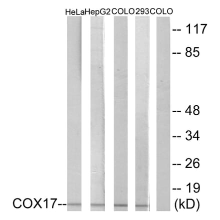 Western Blot - Anti-COX17 Antibody (C12231) - Antibodies.com