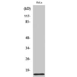Western Blot - Anti-COX17 Antibody (C12231) - Antibodies.com