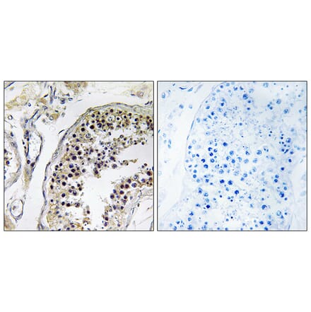 Immunohistochemistry - Anti-CNOT4 Antibody (C15021) - Antibodies.com