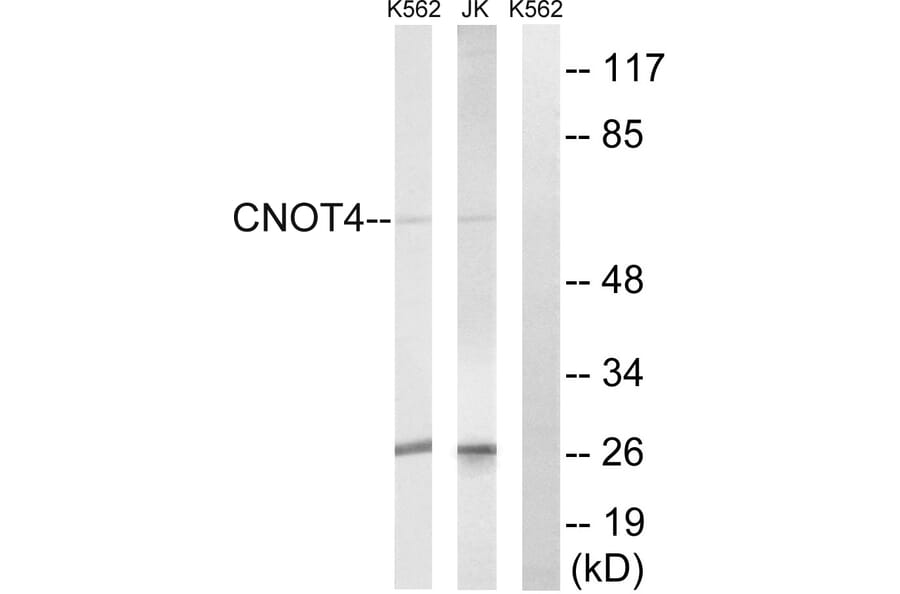 Western Blot - Anti-CNOT4 Antibody (C15021) - Antibodies.com