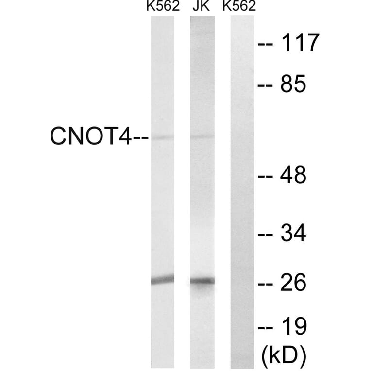 Western Blot - Anti-CNOT4 Antibody (C15021) - Antibodies.com