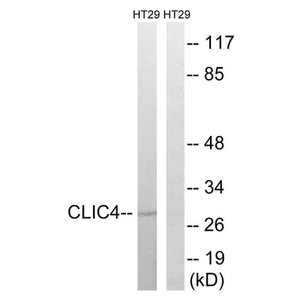 Western Blot - Anti-CLIC4 Antibody (C15090) - Antibodies.com