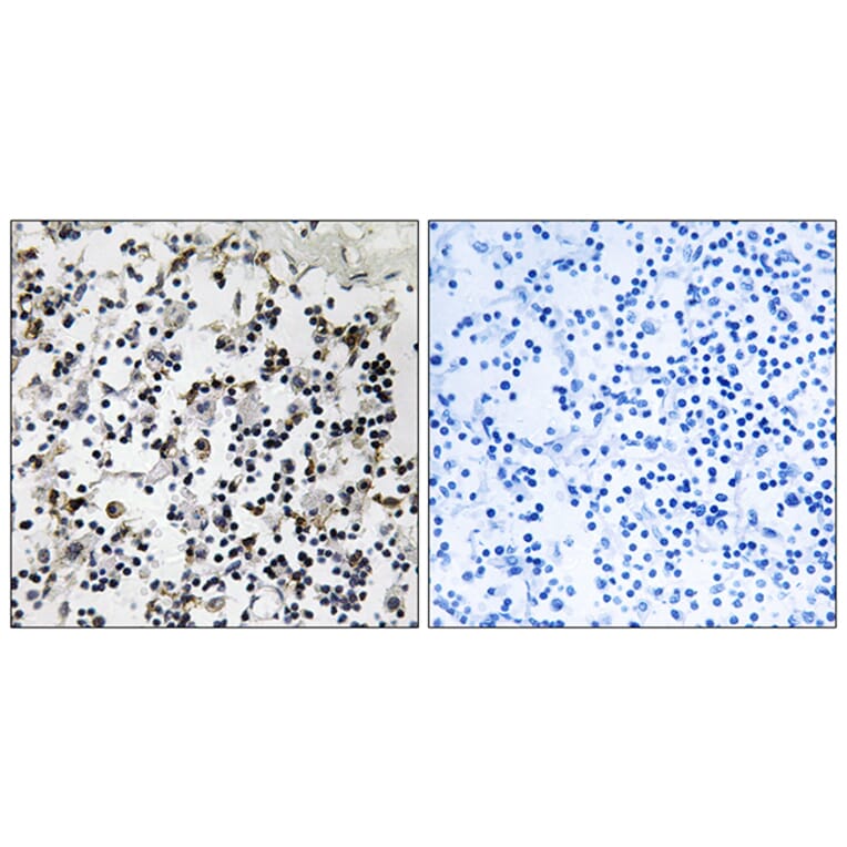 Immunohistochemistry - Anti-CLIC4 Antibody (C15090) - Antibodies.com