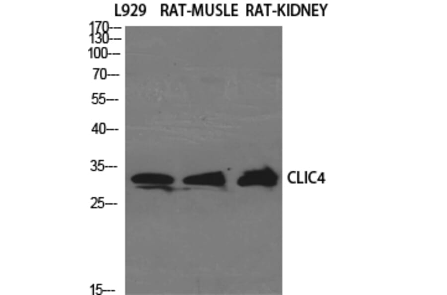 Western Blot - Anti-CLIC4 Antibody (C15090) - Antibodies.com