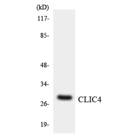 Western Blot - Anti-CLIC4 Antibody (R12-2627) - Antibodies.com