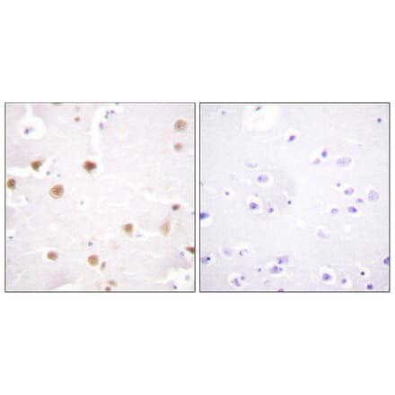 Immunohistochemistry - Anti-c-Jun Antibody (B0868) - Antibodies.com