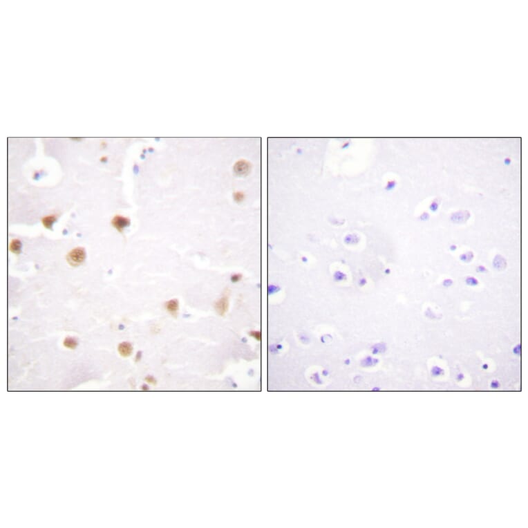 Immunohistochemistry - Anti-c-Jun Antibody (B0868) - Antibodies.com