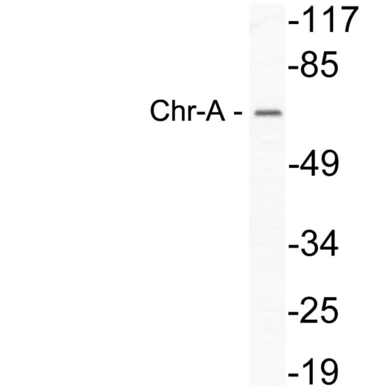 Western Blot - Anti-Chr-A Antibody (R12-2093) - Antibodies.com