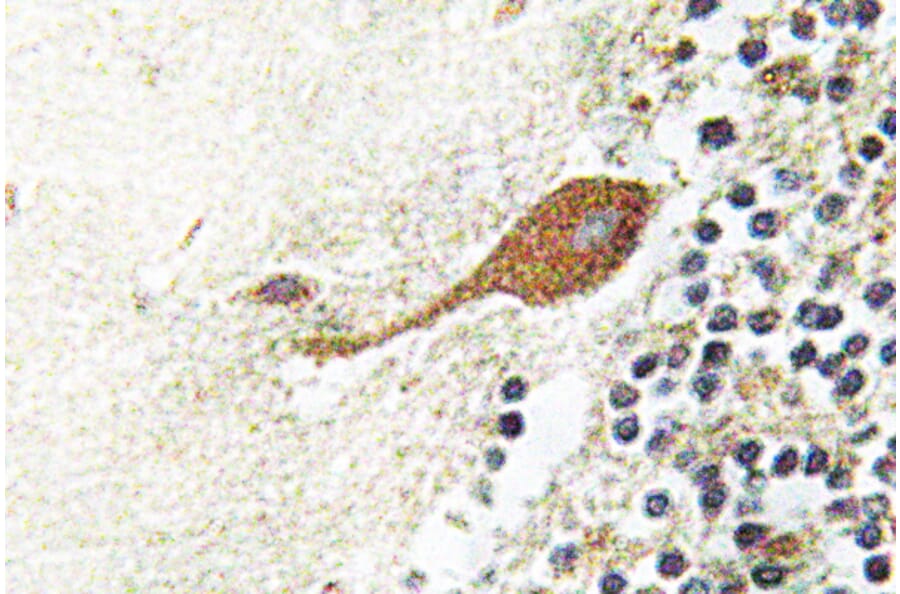 Immunohistochemistry - Anti-Chr-A Antibody (R12-2093) - Antibodies.com