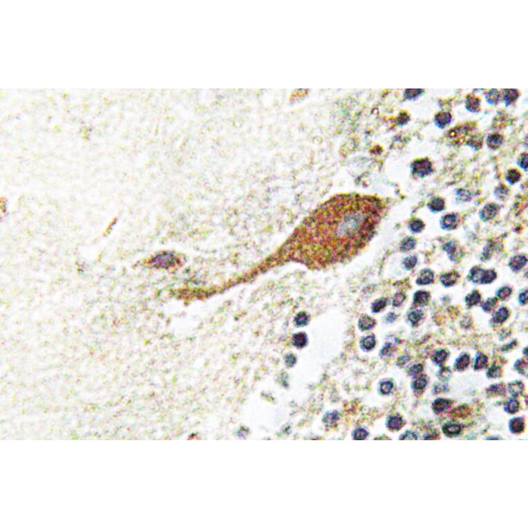 Immunohistochemistry - Anti-Chr-A Antibody (R12-2093) - Antibodies.com