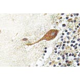 Immunohistochemistry - Anti-Chr-A Antibody (R12-2093) - Antibodies.com
