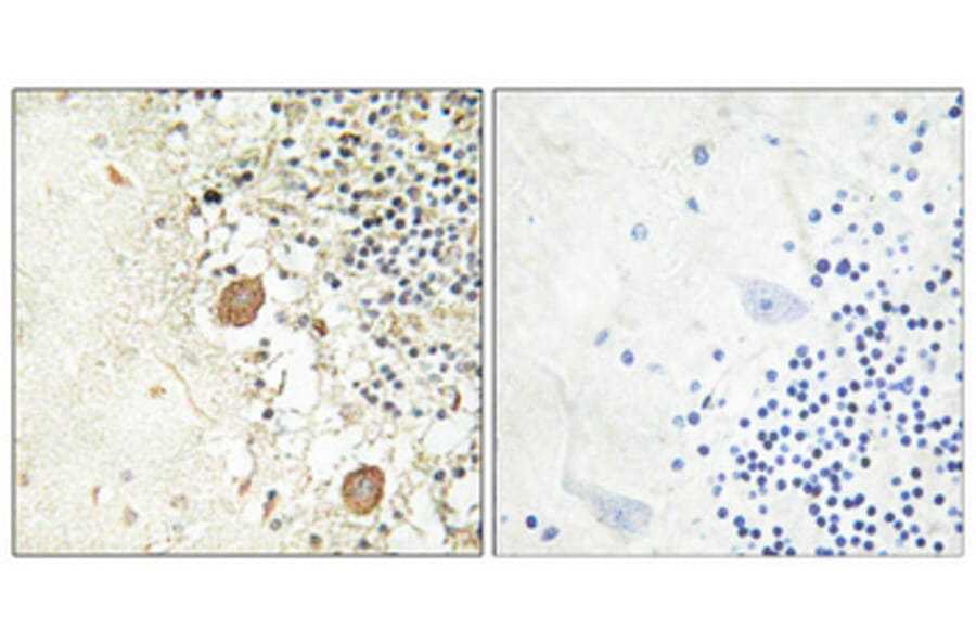 Immunohistochemistry - Anti-Chr-A Antibody (R12-2093) - Antibodies.com