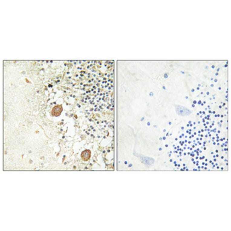 Immunohistochemistry - Anti-Chr-A Antibody (R12-2093) - Antibodies.com