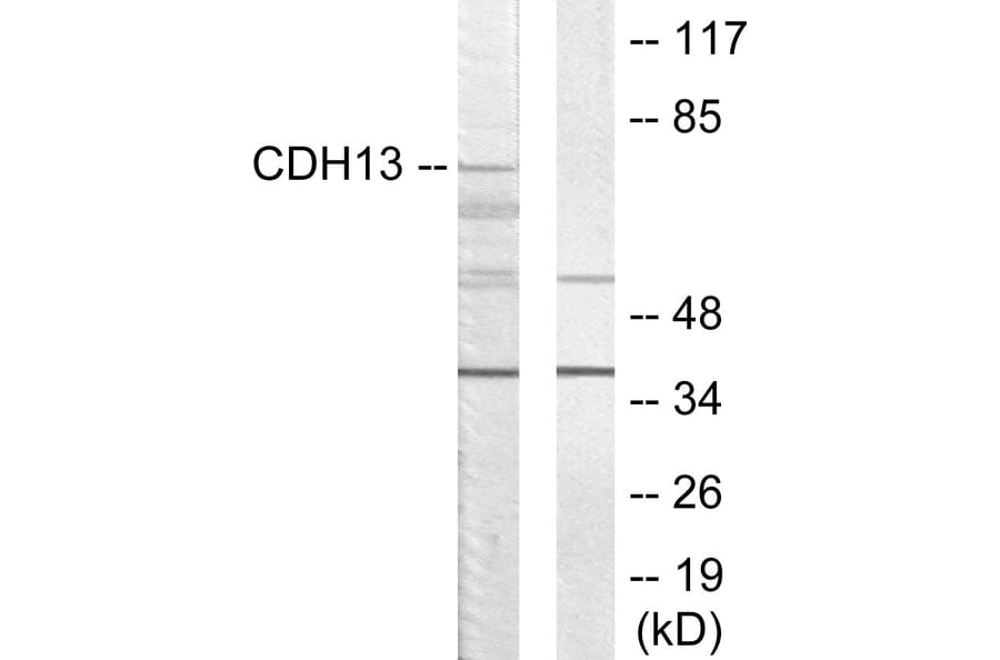Western Blot - Anti-CDH13 Antibody (C12089) - Antibodies.com