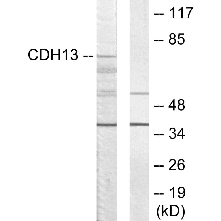 Western Blot - Anti-CDH13 Antibody (C12089) - Antibodies.com