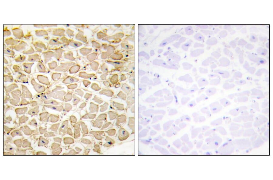 Immunohistochemistry - Anti-CDH13 Antibody (C12089) - Antibodies.com