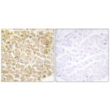 Immunohistochemistry - Anti-CDH13 Antibody (C12089) - Antibodies.com