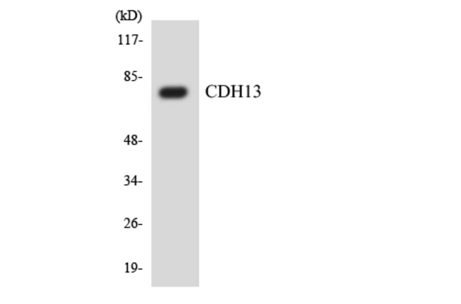Western Blot - Anti-CDH13 Antibody (R12-2600) - Antibodies.com