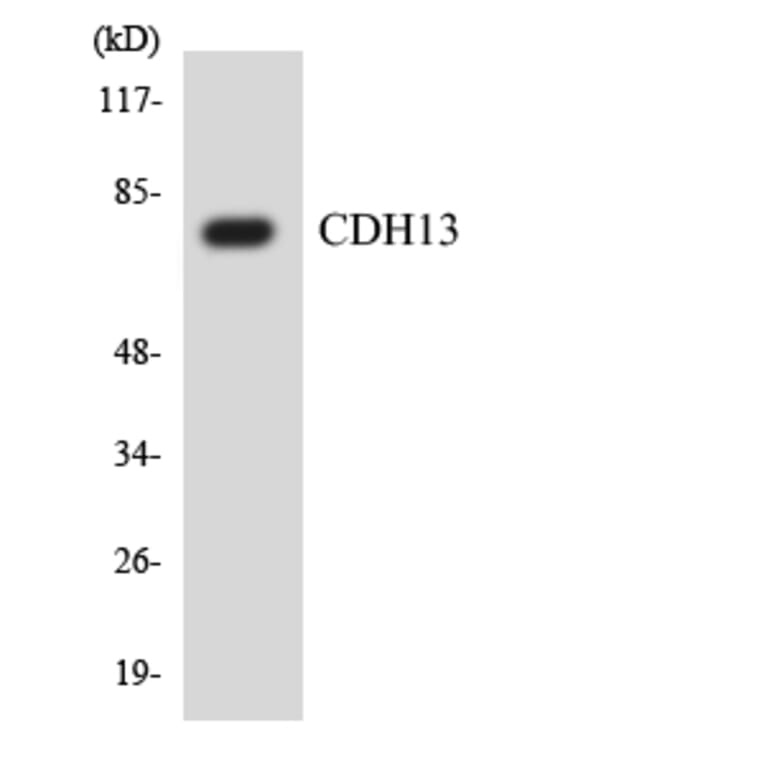 Western Blot - Anti-CDH13 Antibody (R12-2600) - Antibodies.com