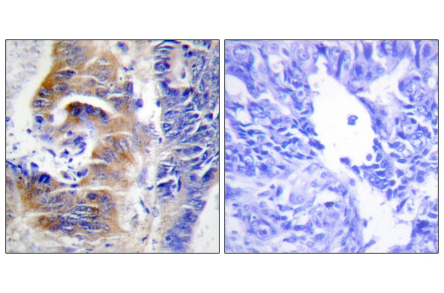 Immunohistochemistry - Anti-CDCA3 Antibody (C12174) - Antibodies.com