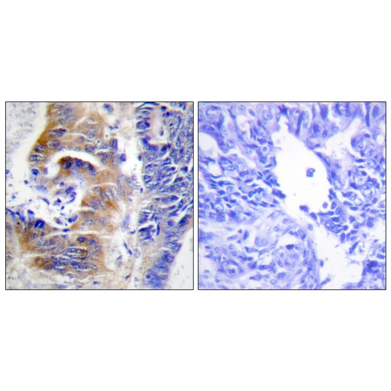 Immunohistochemistry - Anti-CDCA3 Antibody (C12174) - Antibodies.com