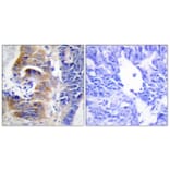 Immunohistochemistry - Anti-CDCA3 Antibody (C12174) - Antibodies.com