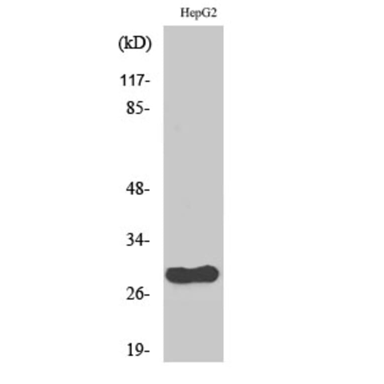 Western Blot - Anti-CDCA3 Antibody (C12174) - Antibodies.com