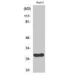 Western Blot - Anti-CDCA3 Antibody (C12174) - Antibodies.com